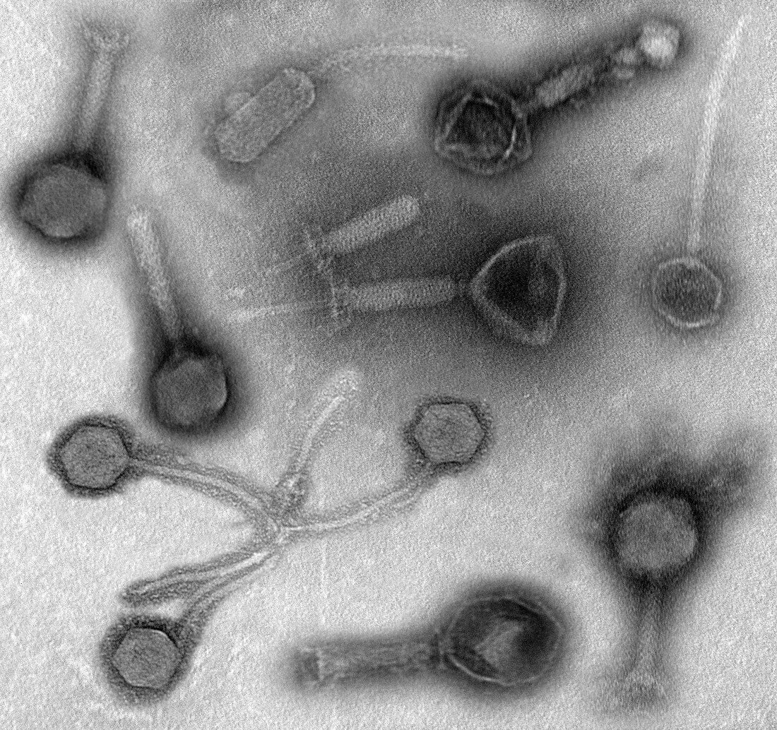 Phage therapy, TEM