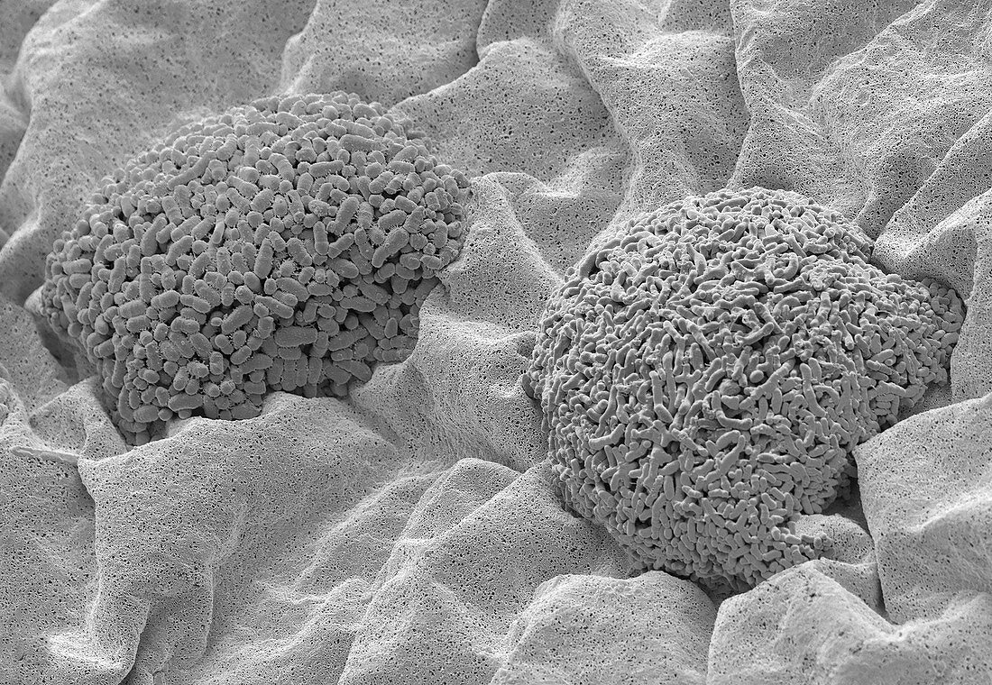 Bacterial culture from the umbilicus, SEM
