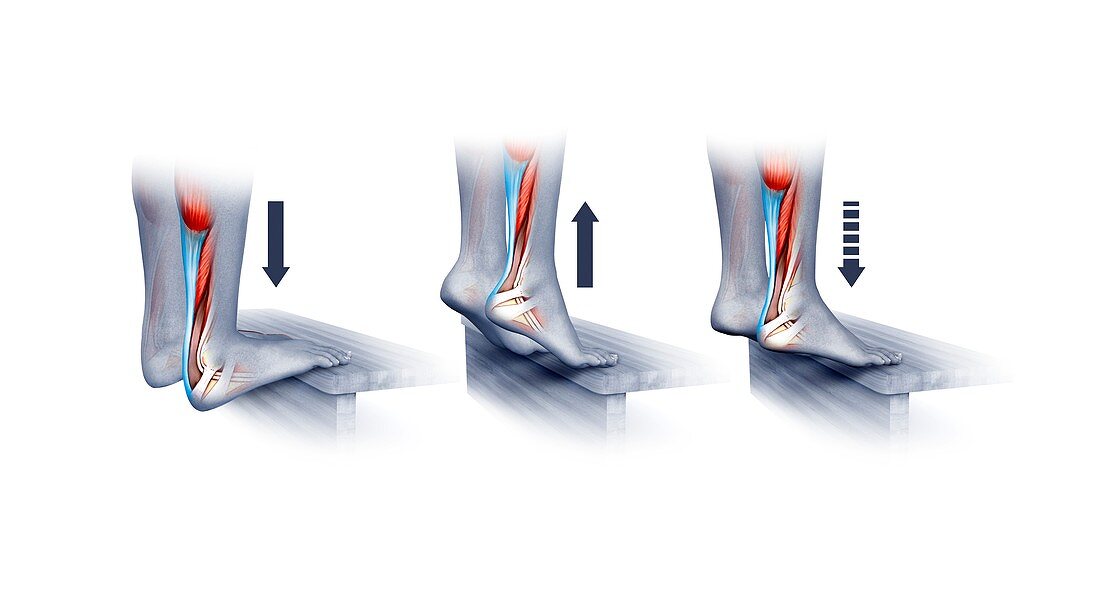 Achilles tendon exercise, illustration