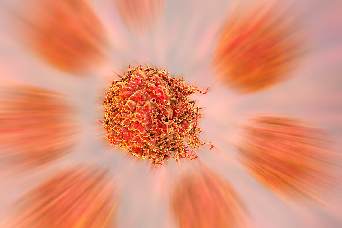 Prostate cancer cells, illustration