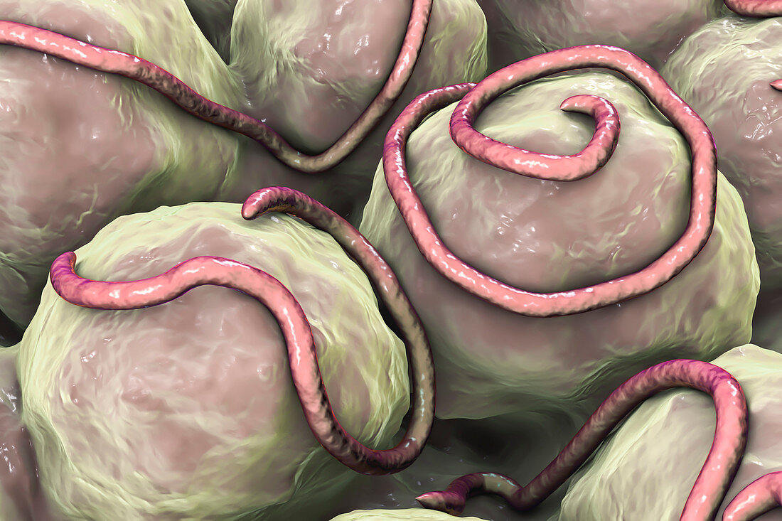 Threadworms in the gut, illustration