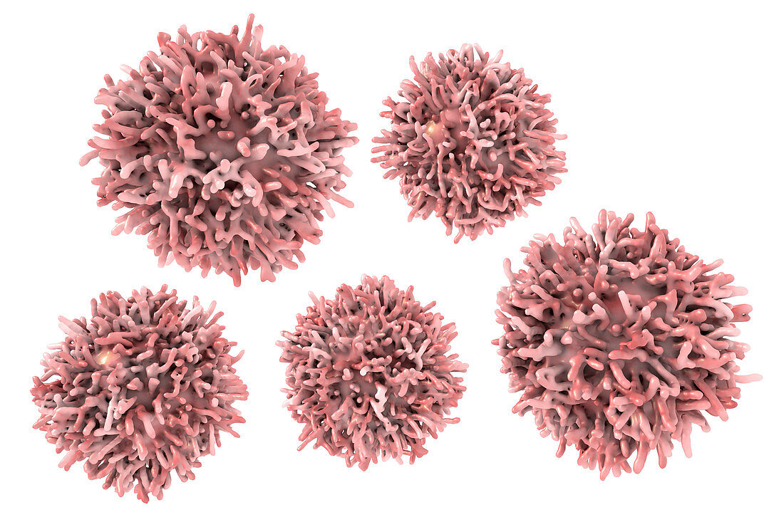 Thyroid cancer cells, illustration