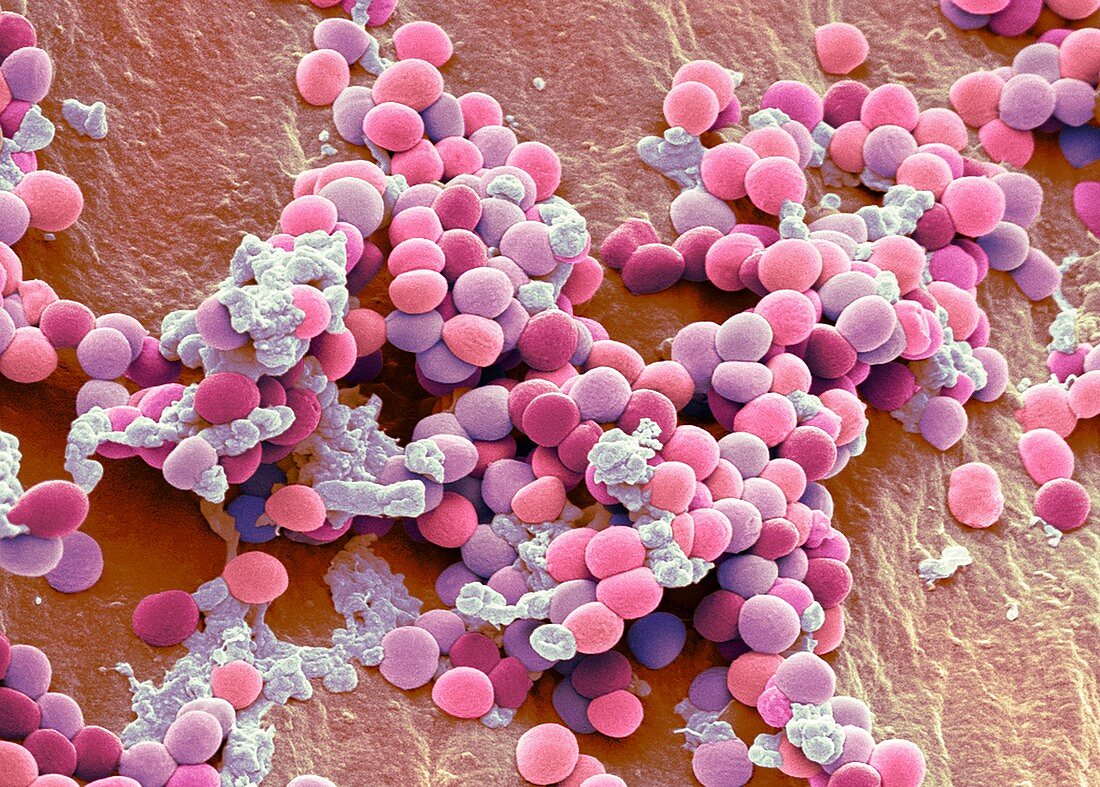 Staphylococcus bacteria, SEM