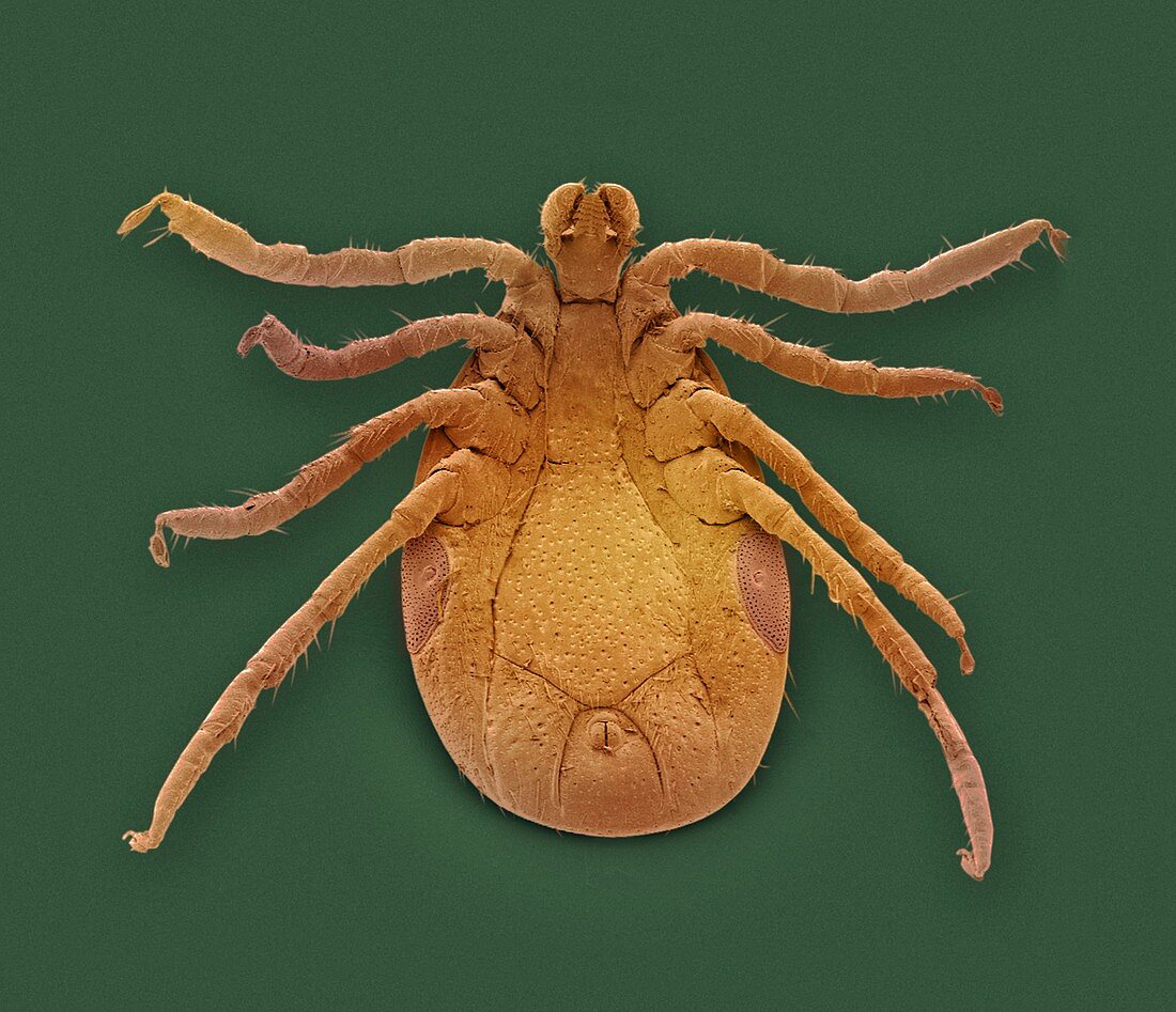 Lyme disease tick, SEM