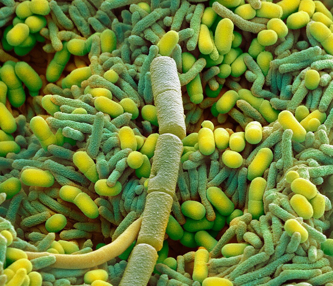 Bacteria from a domestic dishwasher, SEM