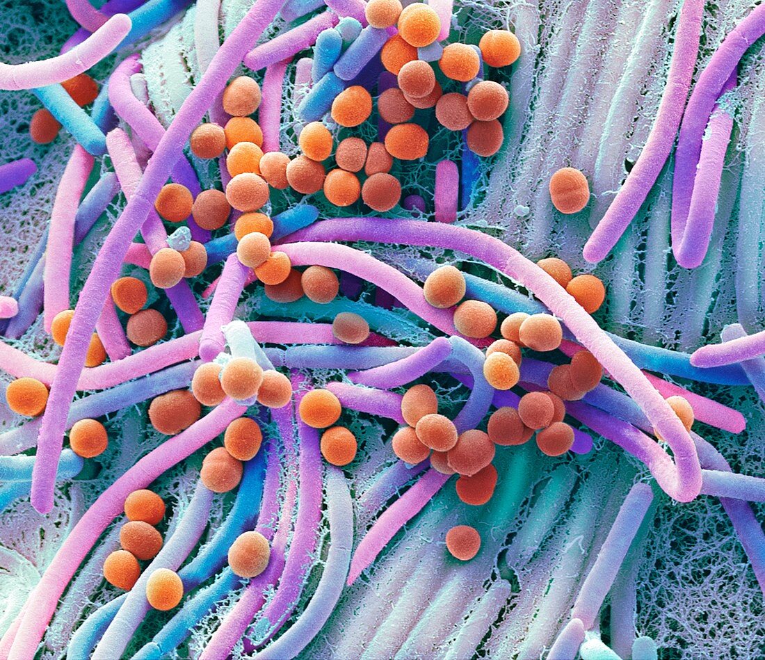 Faecal bacteria, SEM