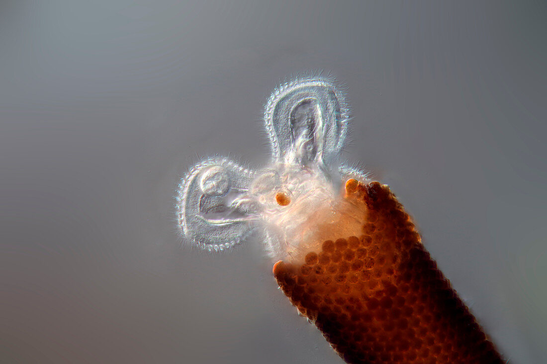 Floscularia rotifer, light micrograph