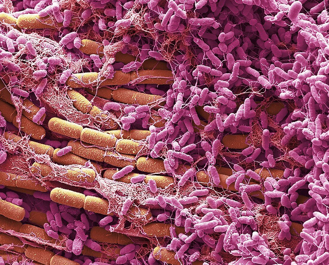 Bacteria from a house fly, SEM