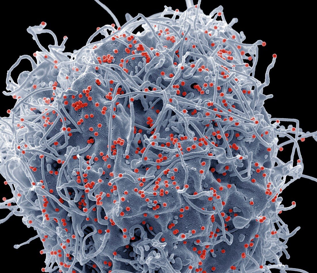 HIV infected 293T cell, SEM