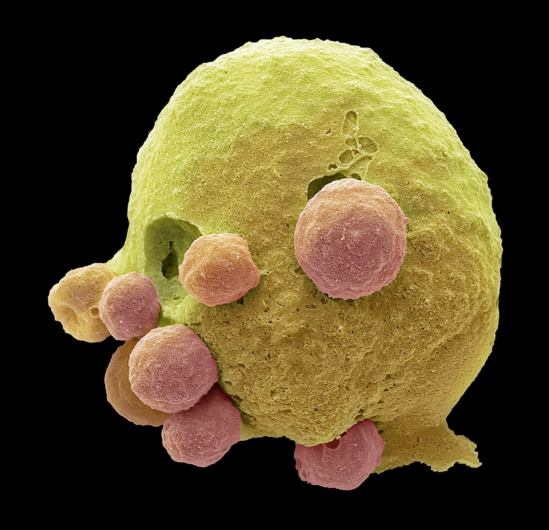 Apoptotic cell, SEM