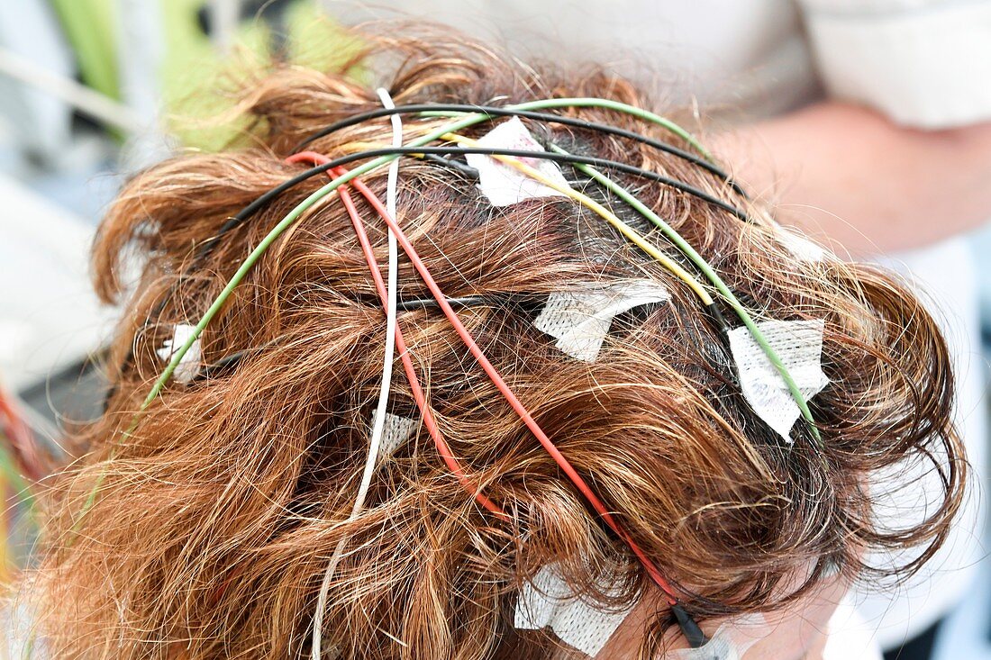 Electroencephalography electrodes attached to scalp