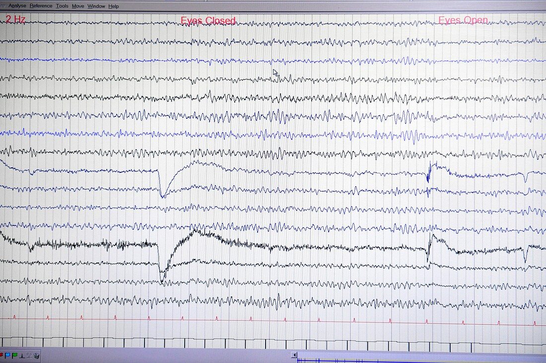 Brain waves recorded on an EEG