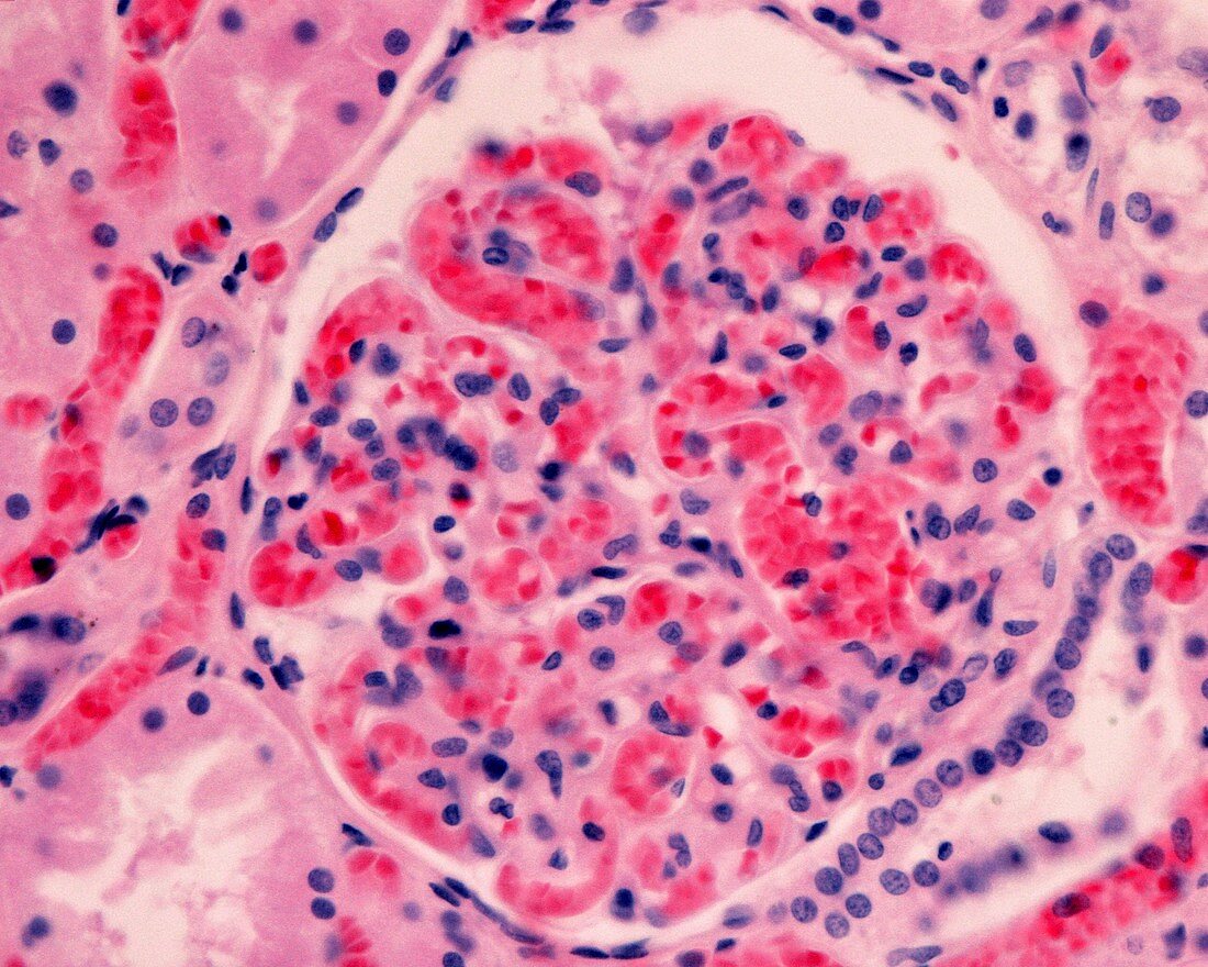 Glomerular congestion, light micrograph