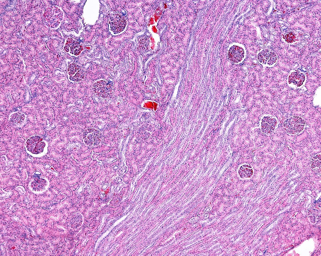 Renal cortex, light micrograph