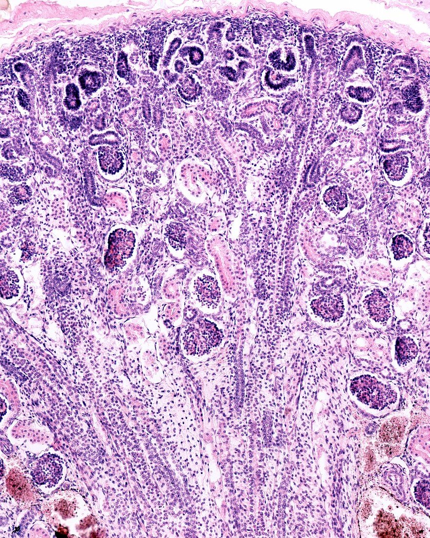 Developing kidney , light micrograph