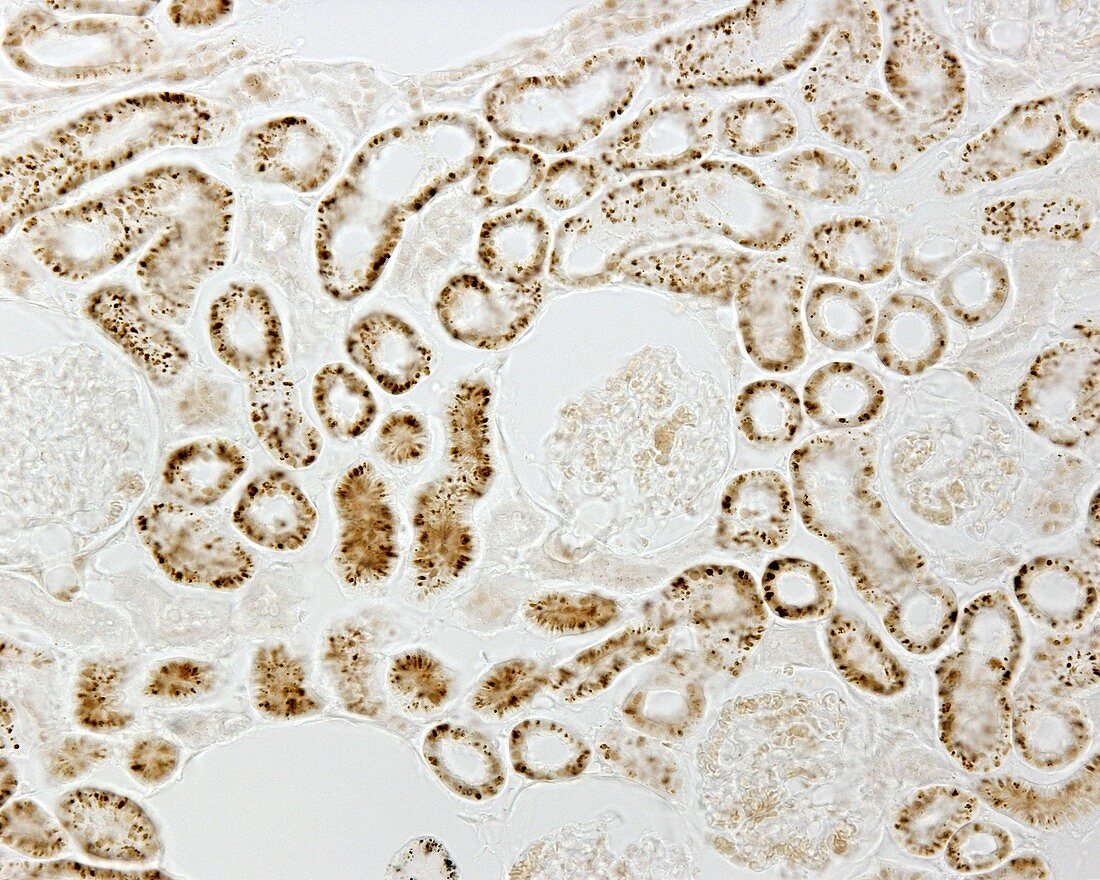 Lysosomes in a kidney, light micrograph