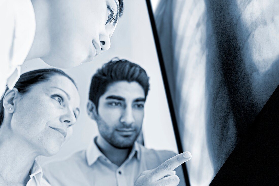Male and Doctors looking at x-ray of ribcage