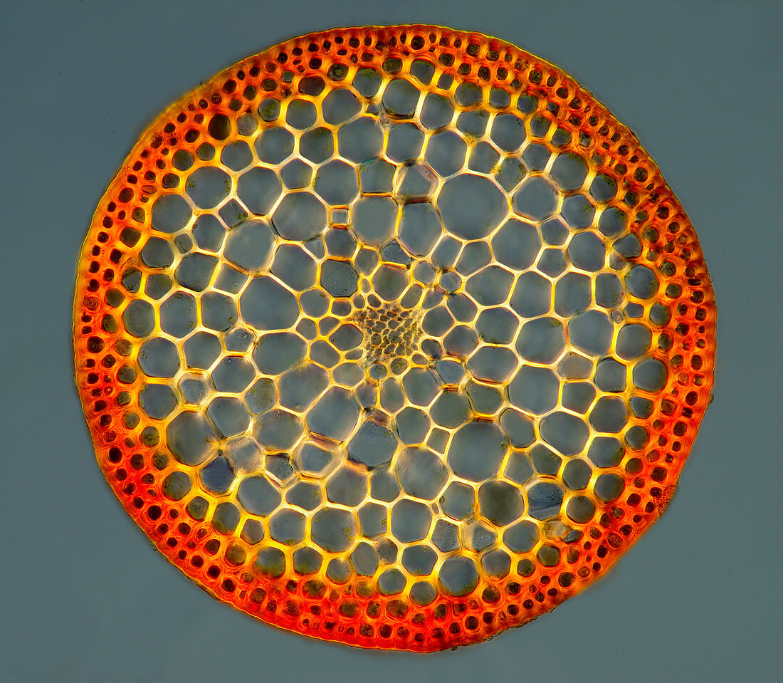 Moss sporophyte, light micrograph