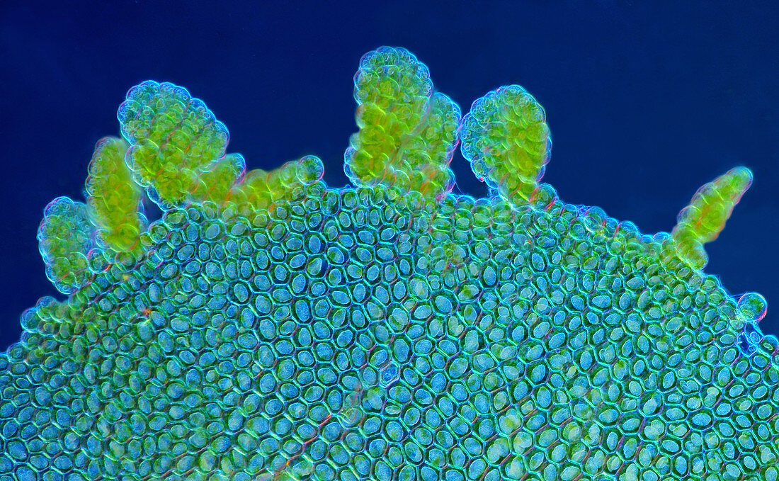 Liverwort leaf, light micrograph