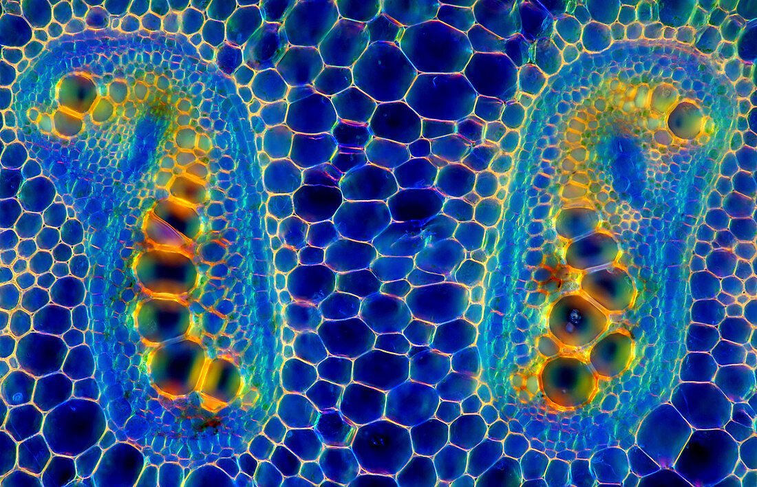 Fern stem, light micrograph
