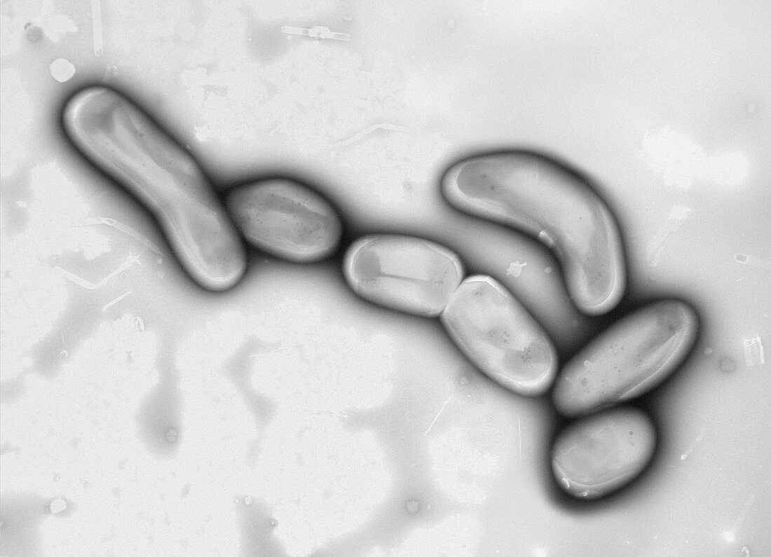 Mycobacterium chimaera bacteria, TEM