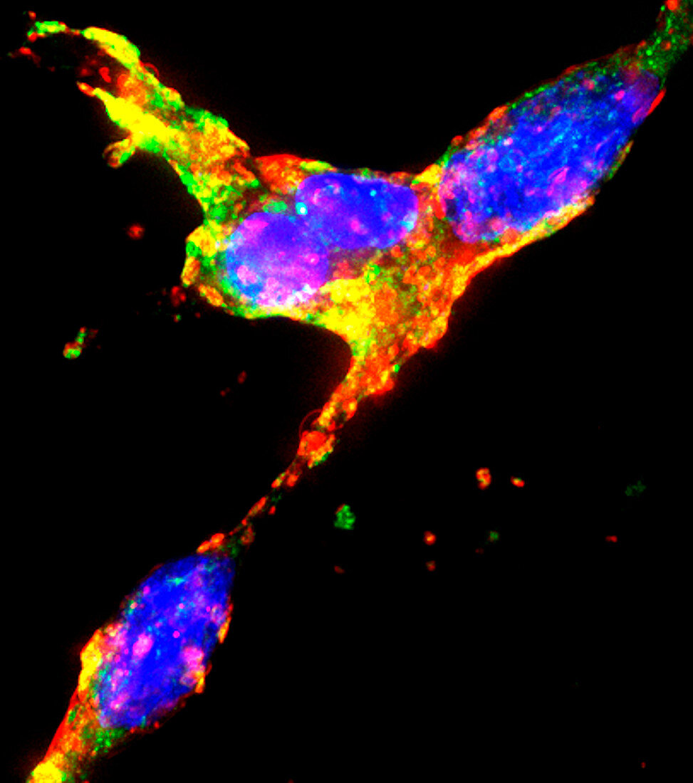 Trophoblasts, fluorescence micrograph