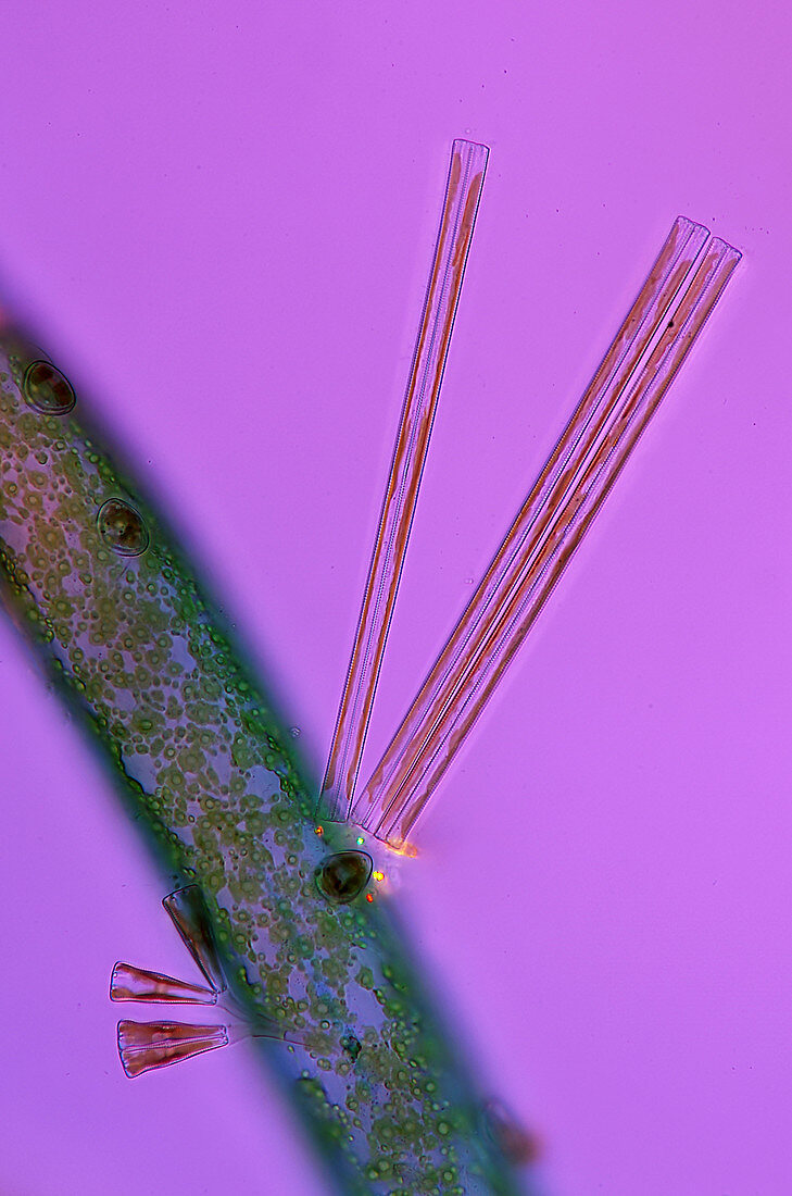 Diatoms, light micrograph