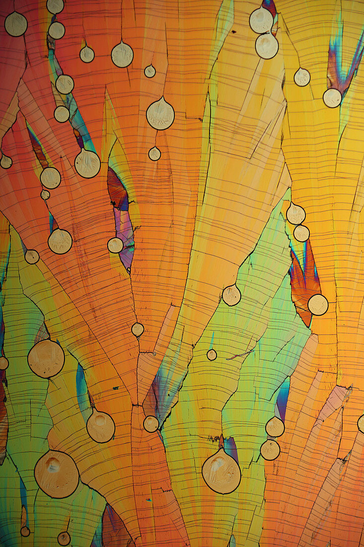 Dopamine crystals, polarised light micrograph