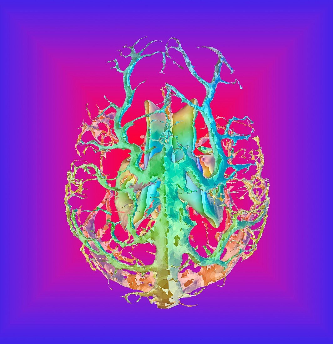 Human brain ventricles and veins, 3D MRI scan