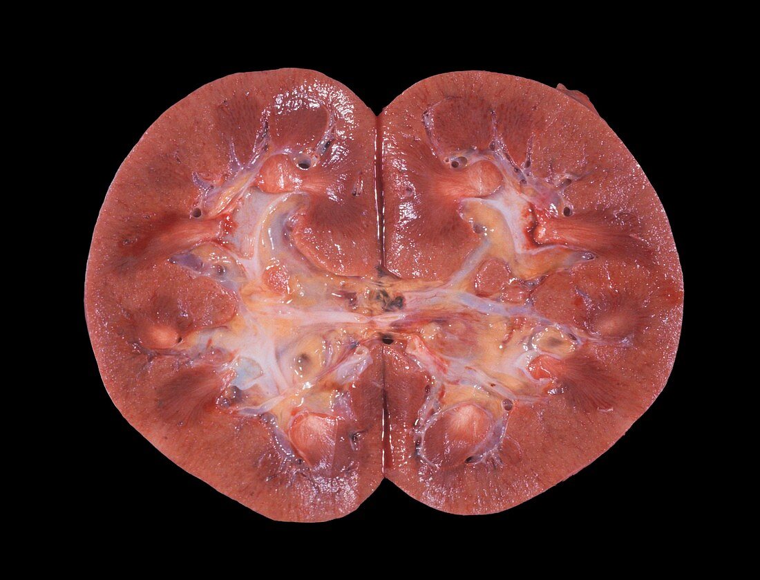 Macro section of a normal human kidney