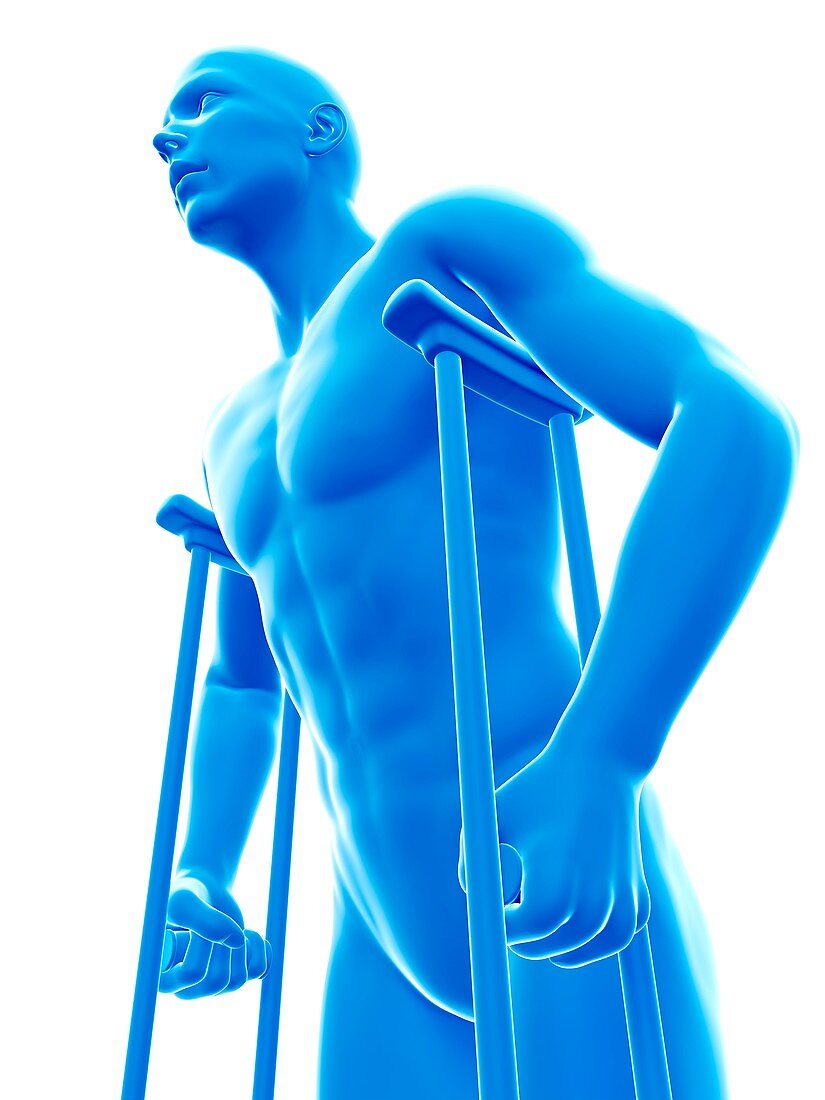 Man on crutches, illustration