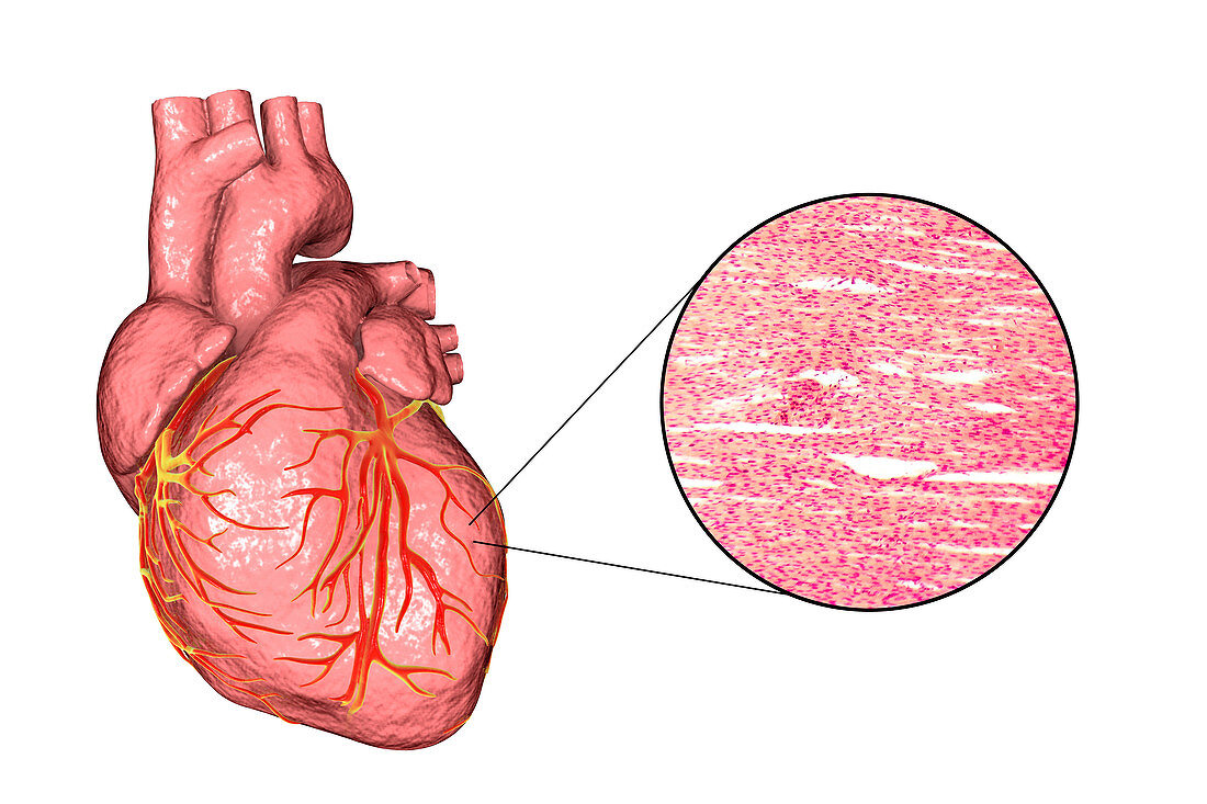 Human heart and cardiac muscle, composite image