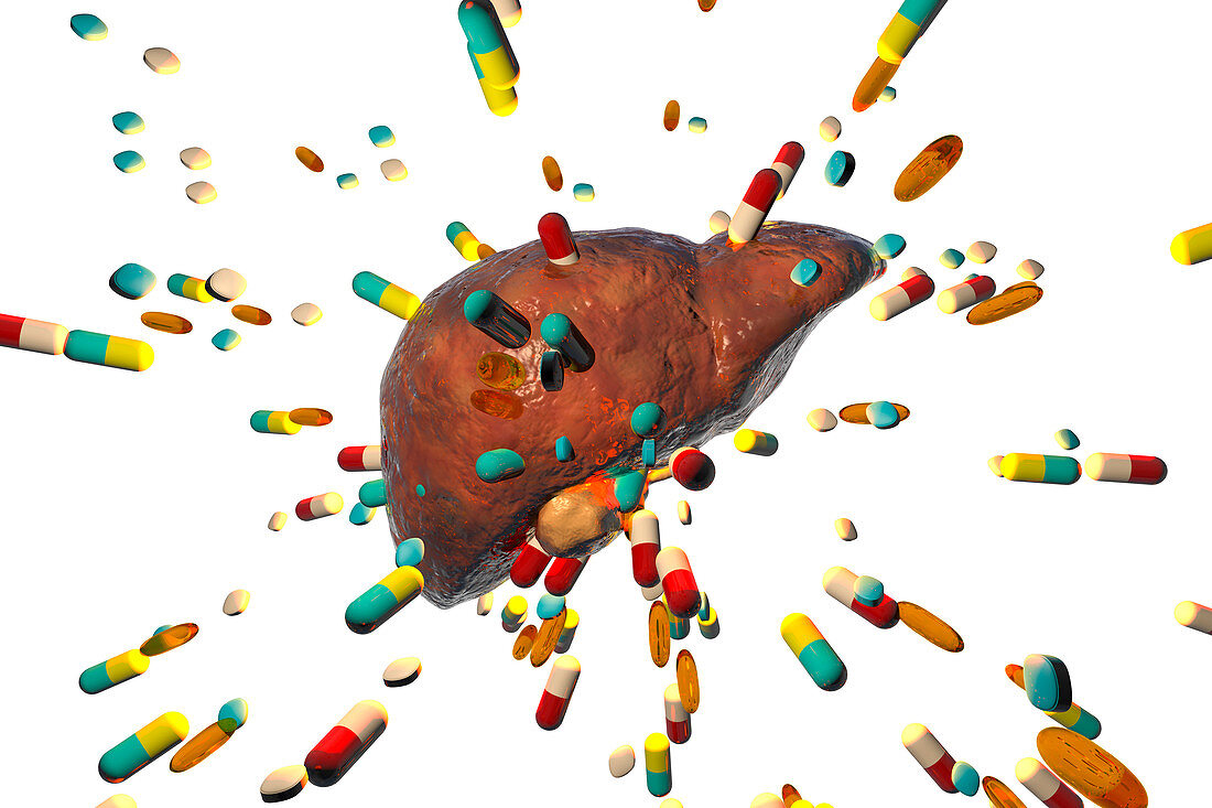 Drug-induced hepatotoxicity, illustration
