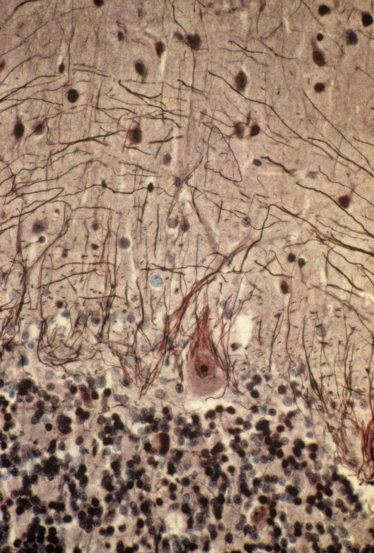 Purkinje nerves cells, light micrograph