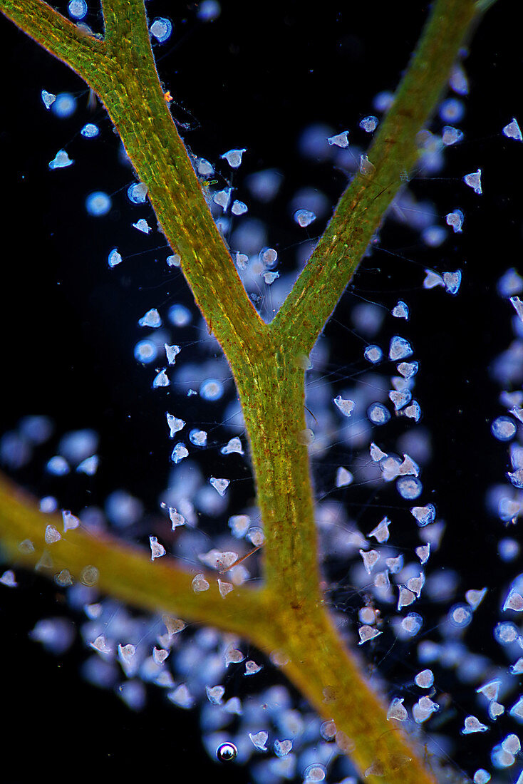 Vorticella ciliates on bladderwort plant, light micrograph