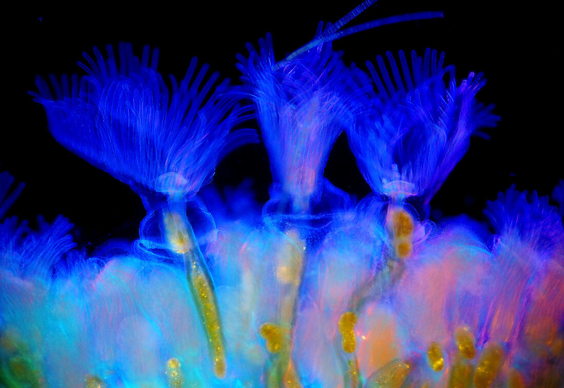 Bryozoans, light micrograph