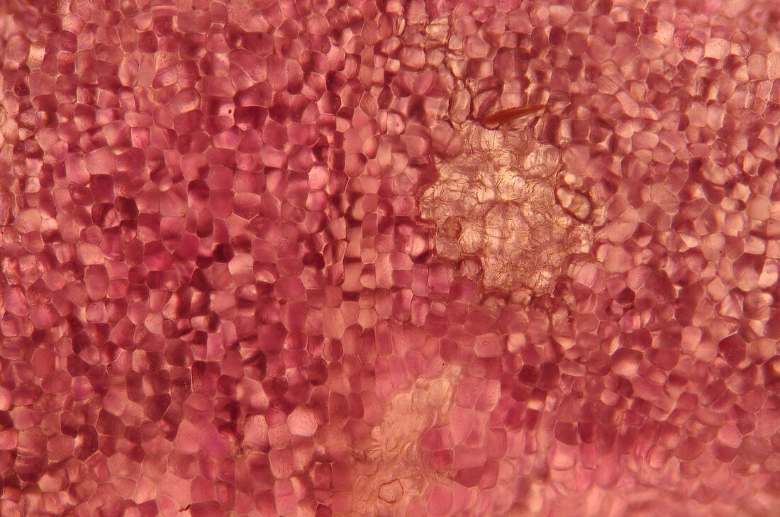 Spurge laurel petal tissue, light micrograph