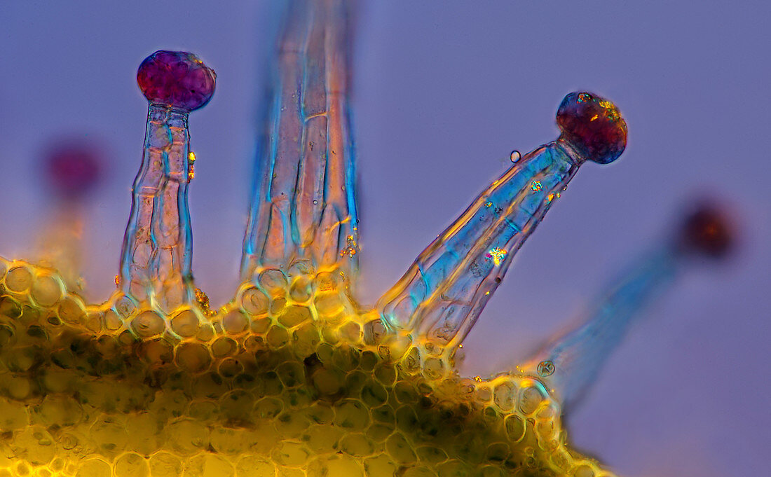 Heuchera plant trichomes, light micrograph