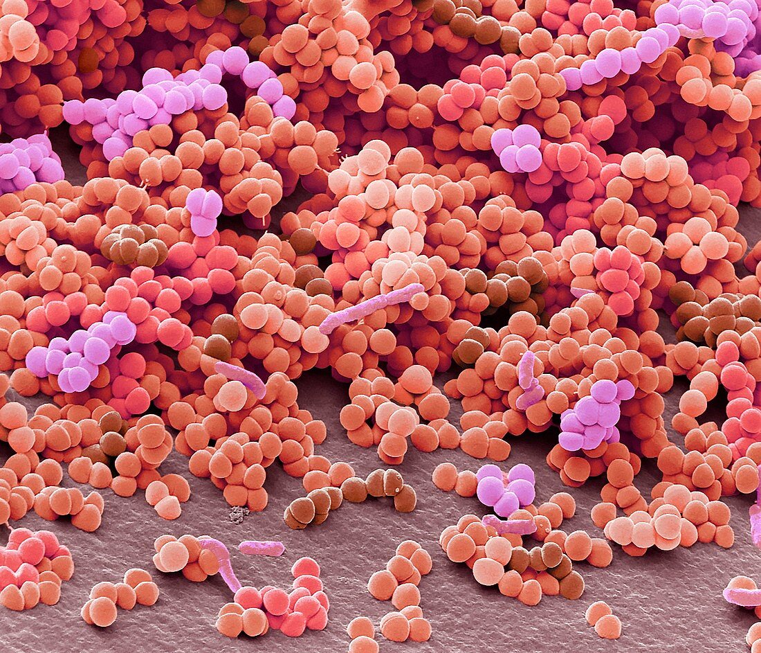 Folliculitis bacteria, SEM