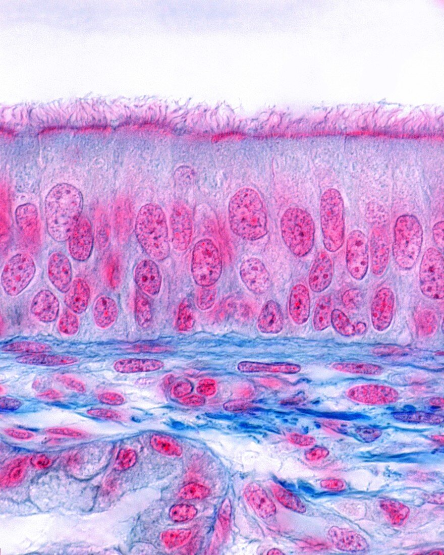 Ciliated pseudostratified columnar epithelium, LM
