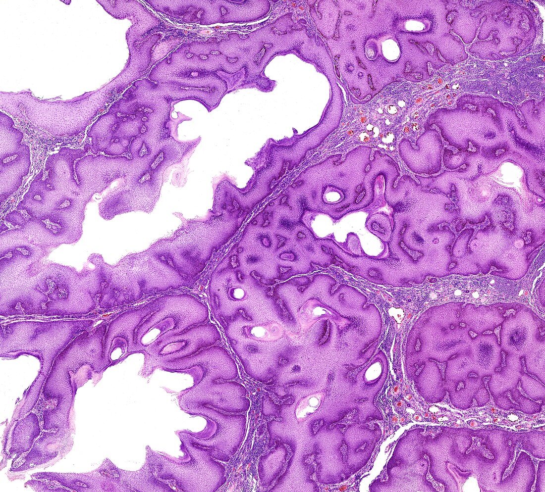 Larynx epithelia, light micrograph