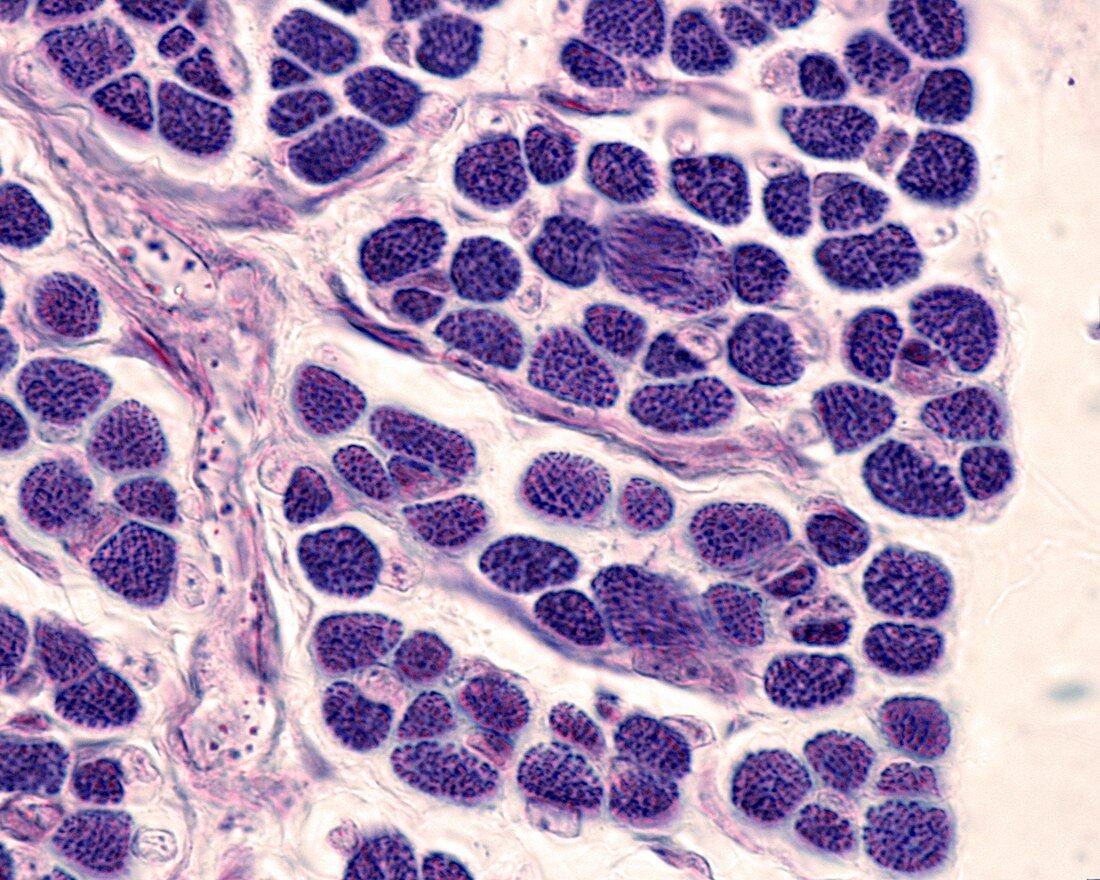 Immature skeletal muscle fibres, LM