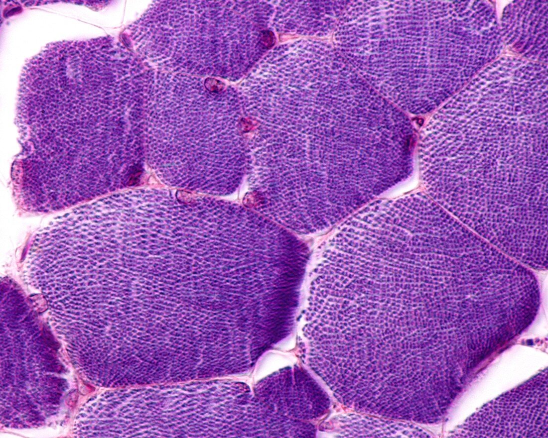 Skeletal muscle fibres, light micrograph