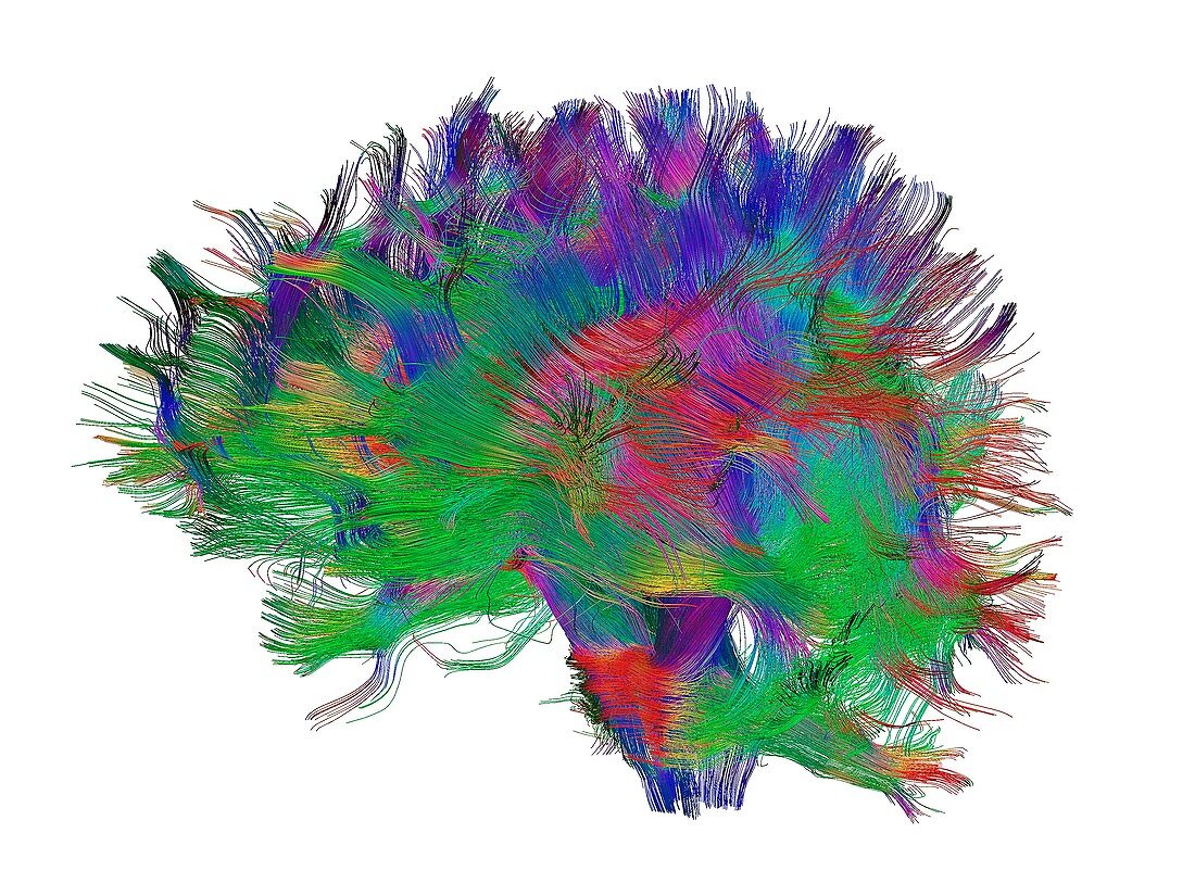 Brain fibres side view left, DTI scan