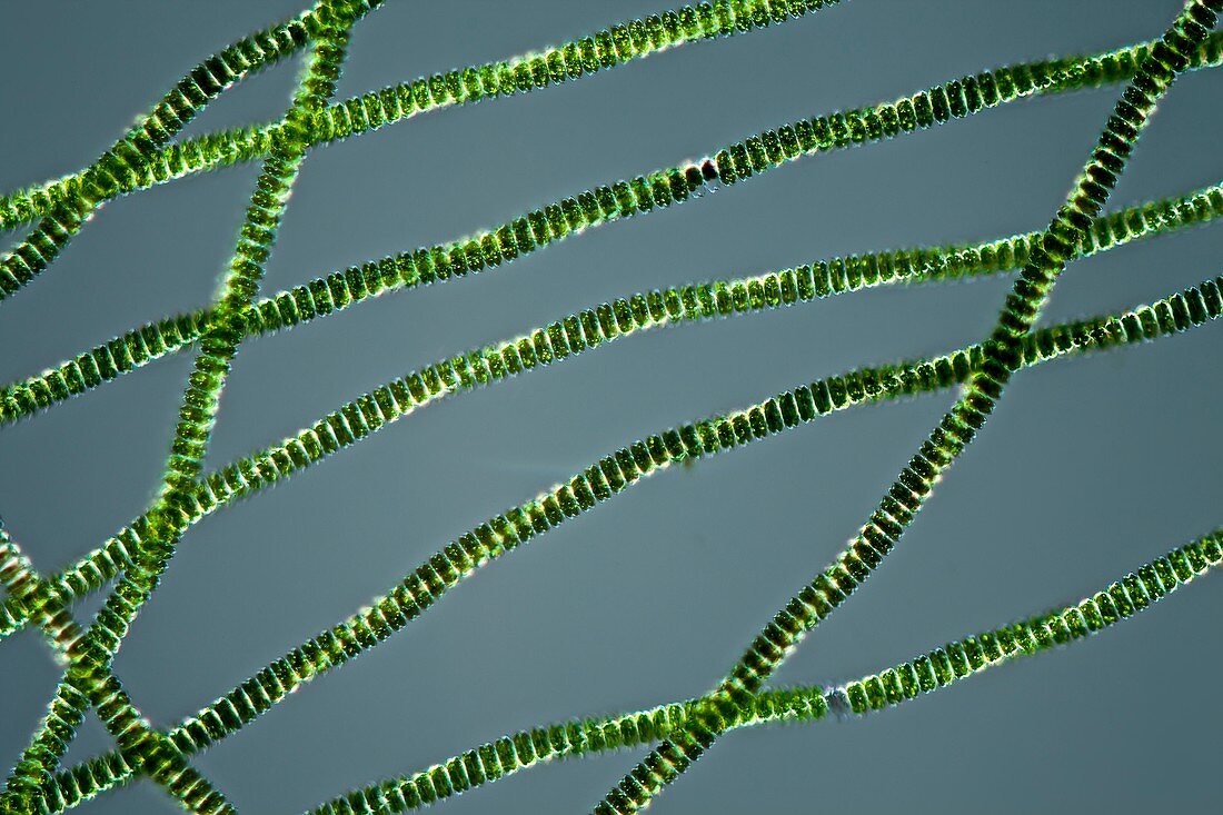 Desmidium swartzii algae filaments, light micrograph