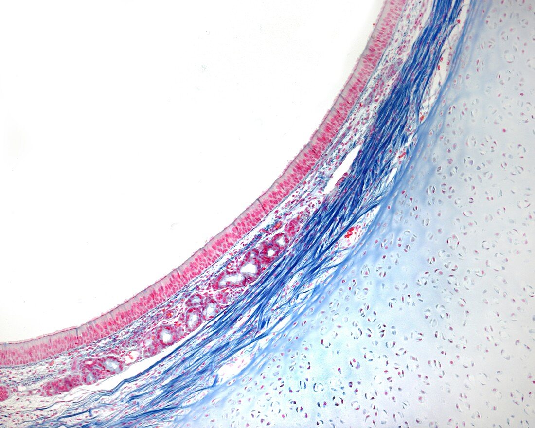 Layers of trachea wall, light micrograph