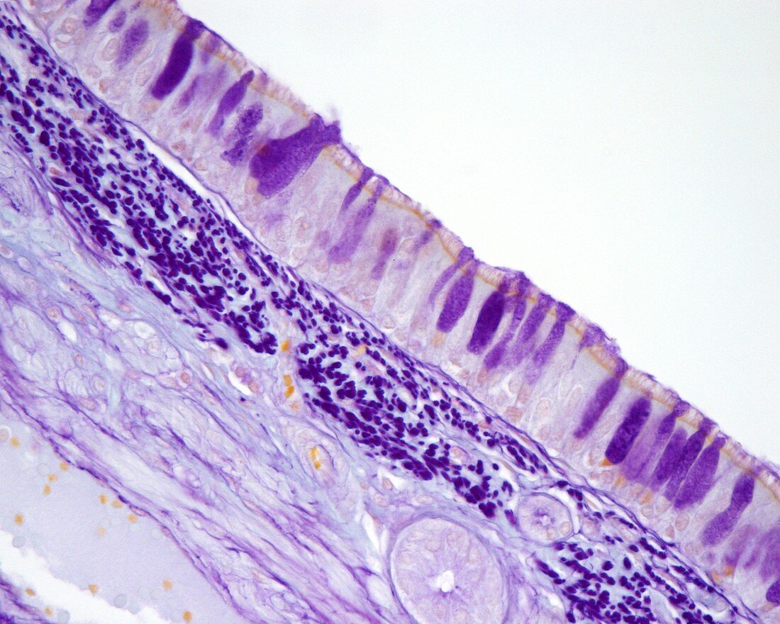 Tracheal mucosa, light micrograph
