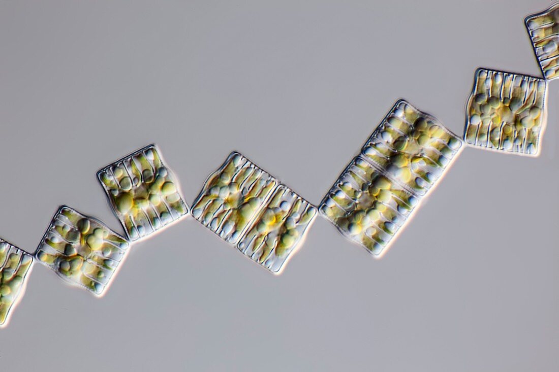 Tabellaria diatoms, light micrograph