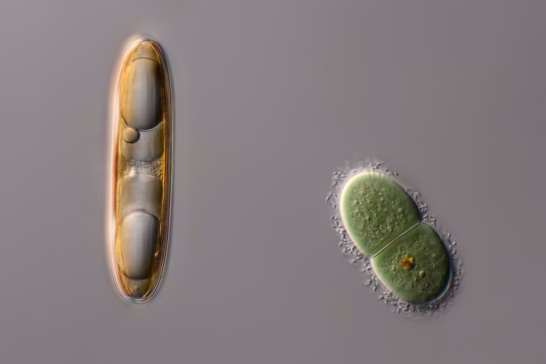 Diatom an a Chroococcus cyanobacterium, light micrograph