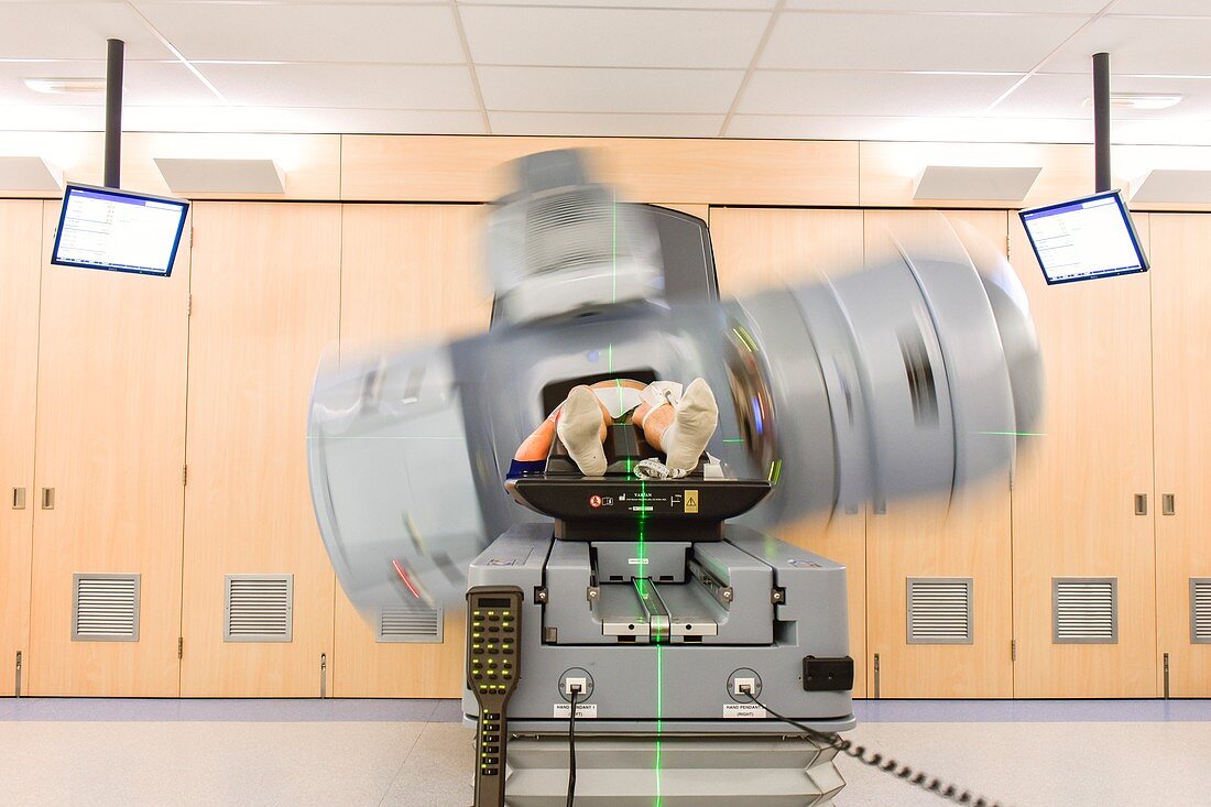 Prostate cancer radiotherapy, timelapse image
